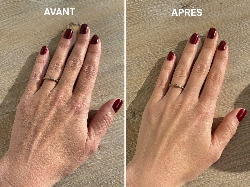 Avant / après — peau des mains, résultat vérifié Ondéa