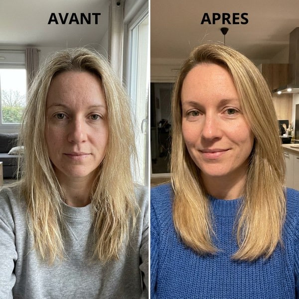 Avant / après — visage, résultat vérifié Ondéa