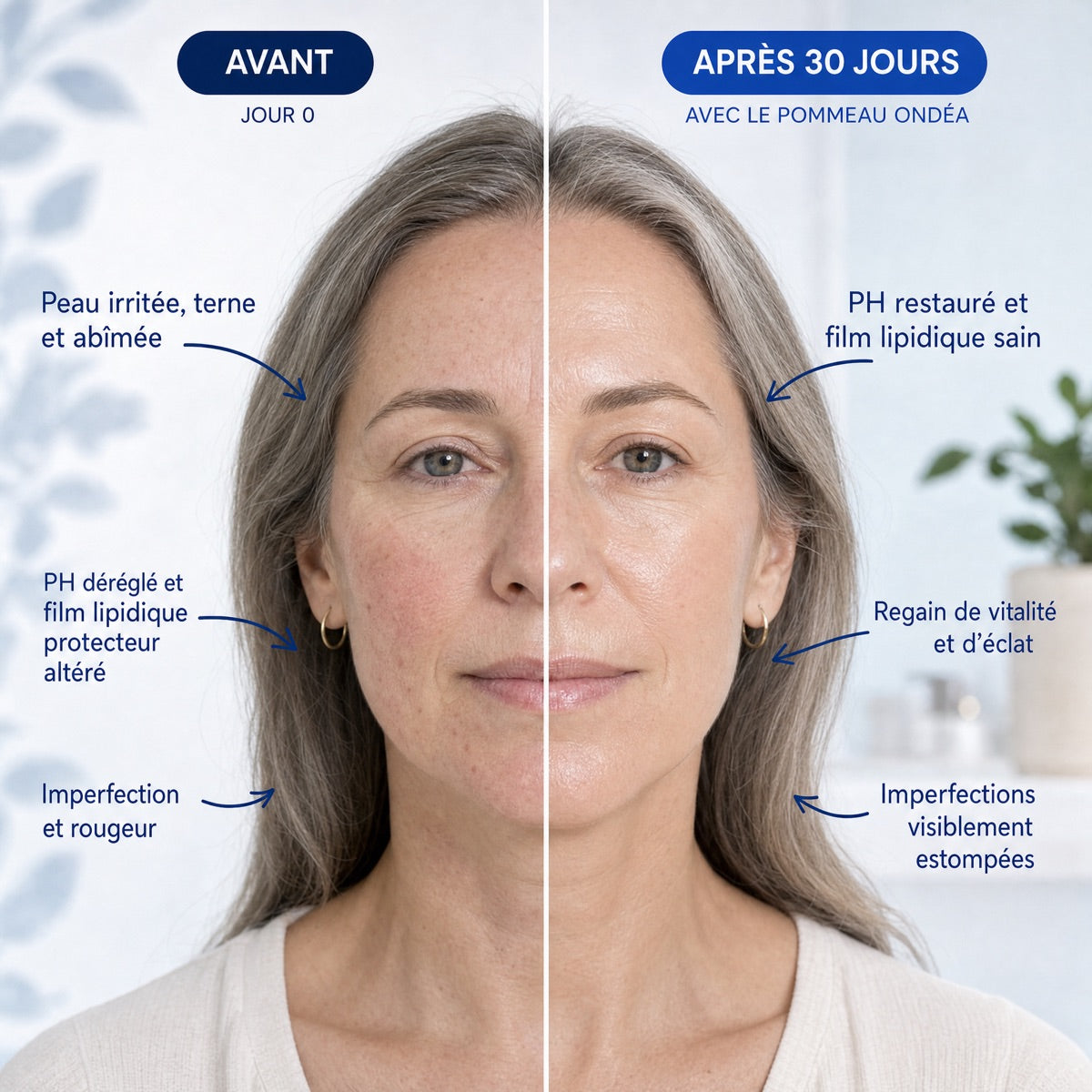 Avant / après peau — 30 jours