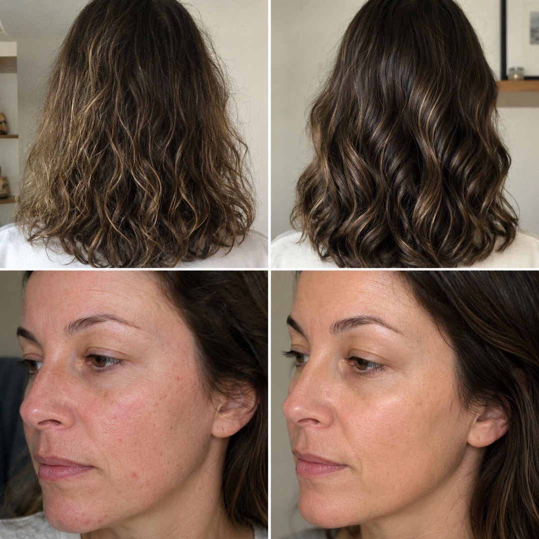 Avant / après — cheveux et peau, résultat vérifié Ondéa